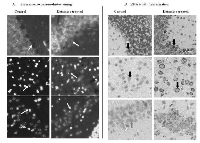 Fig. (5). Comparison of protein and RNA expression of Tnnt1 in brain tissue of mice treated with ketamine.