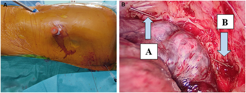 Figure 2: