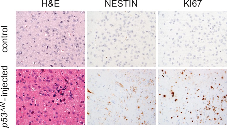 Figure 2—figure supplement 6.