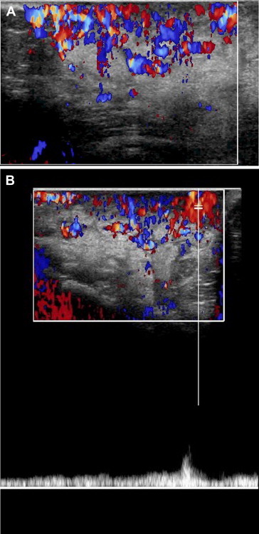 Fig. 4