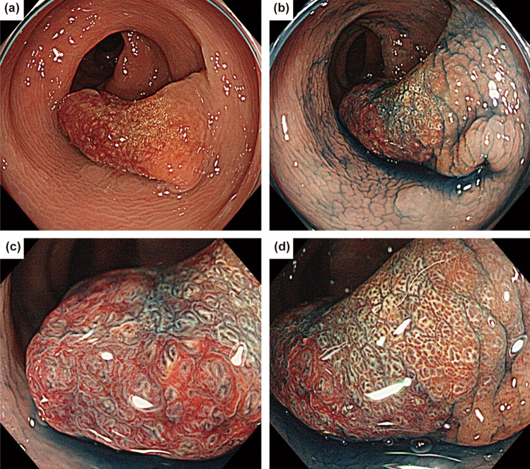 Fig. 1