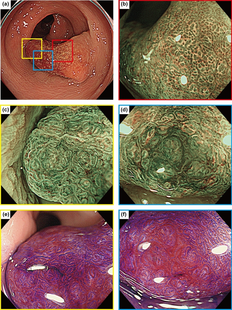 Fig. 2