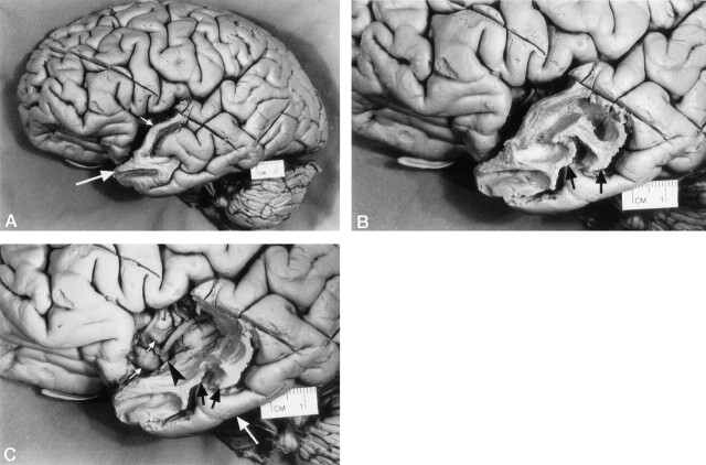 Fig 2.