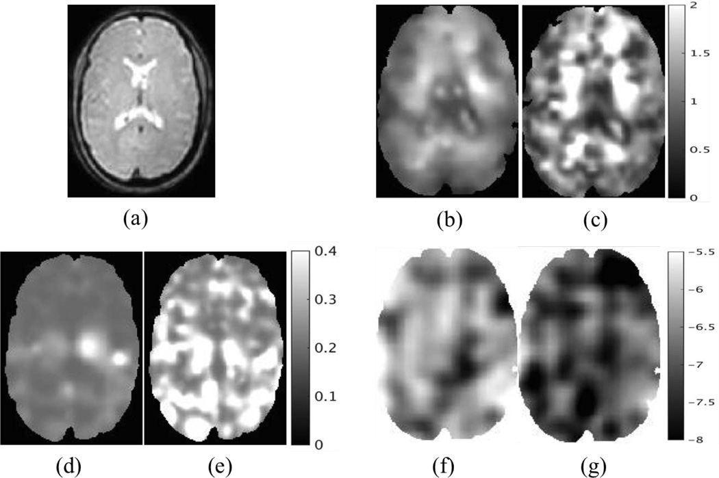 Fig. 12