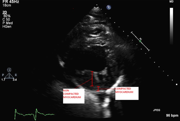 Figure 1