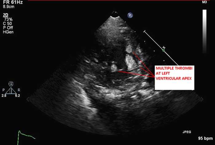 Figure 2