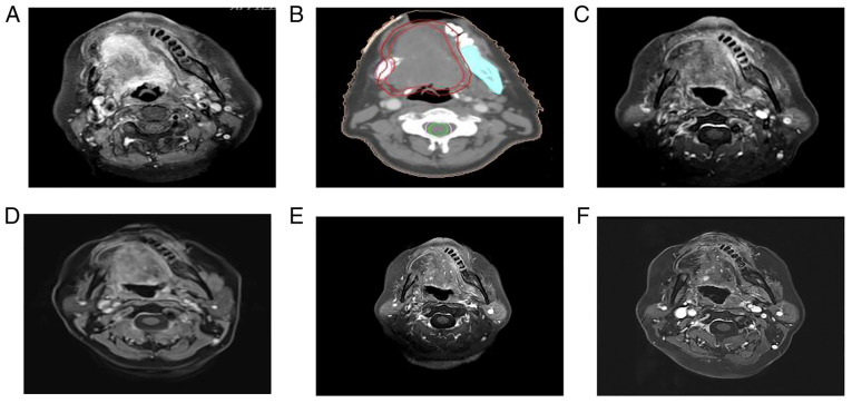 Figure 3.