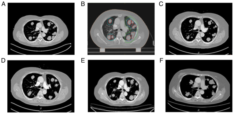 Figure 4.