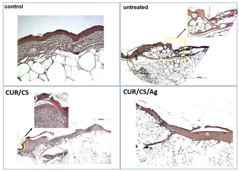 Figure 11