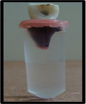 Fig. 2: Mounted teeth with radicular portion including CEJ immersed in distilled water.