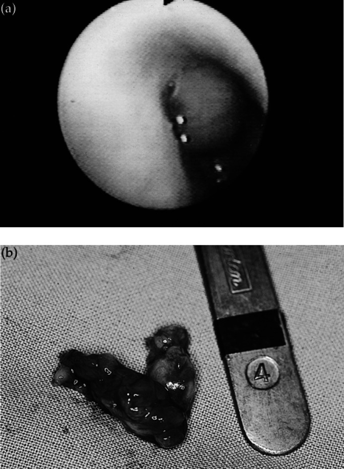 Fig 2.