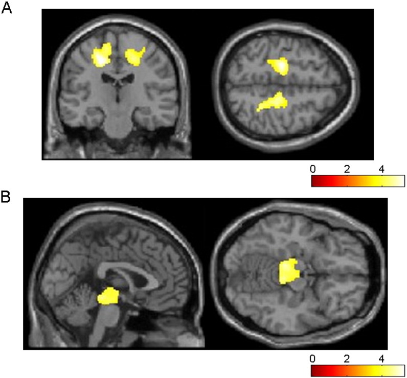 Fig. 3