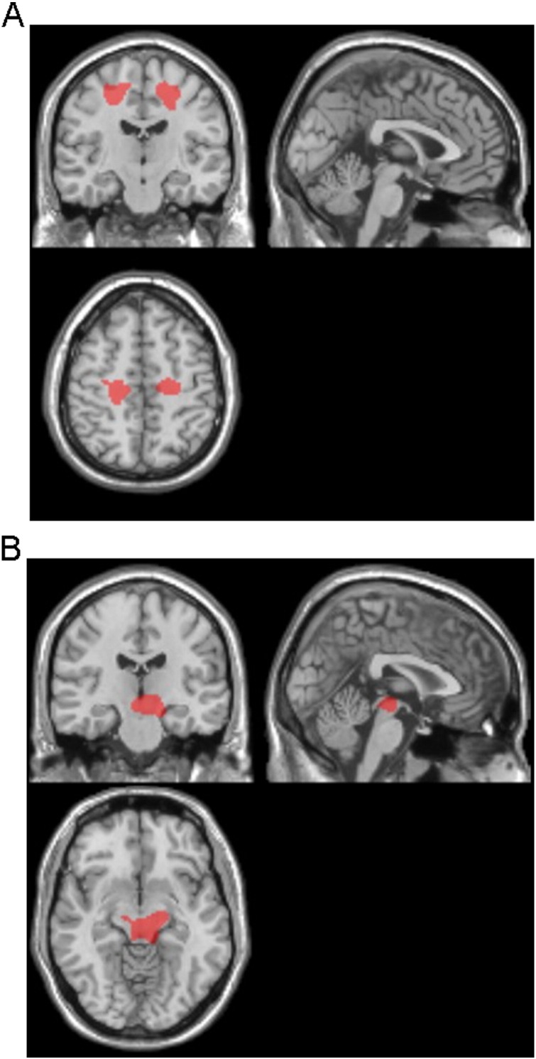 Fig. 4