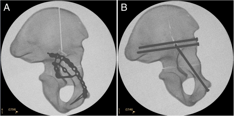 Fig. 1