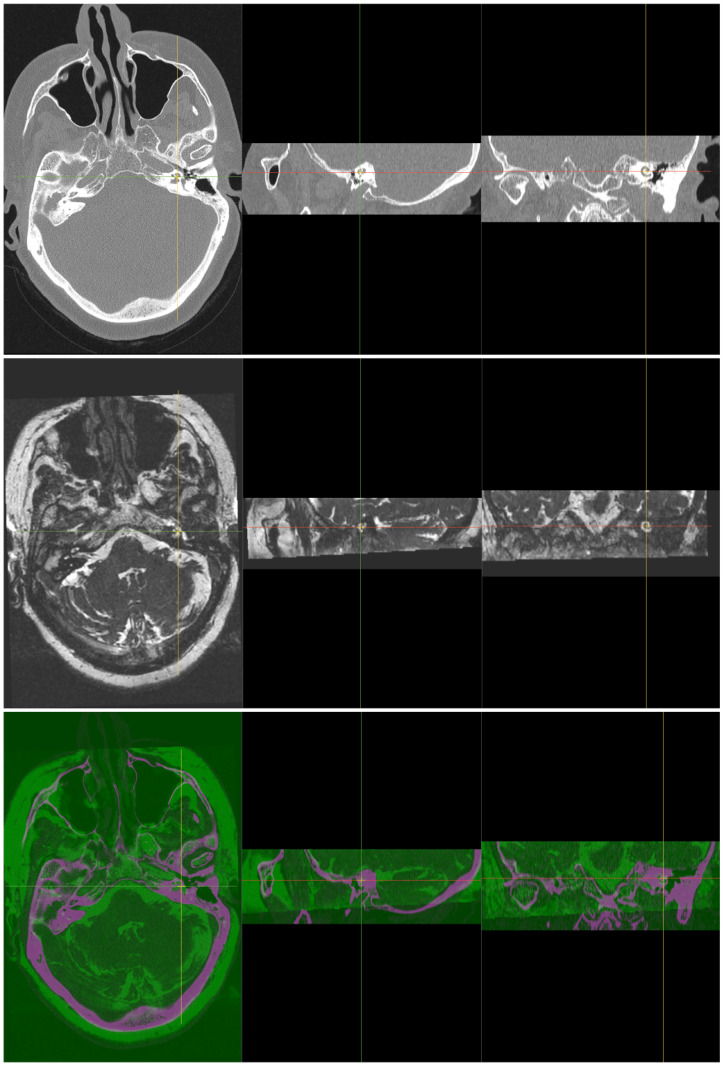 Fig 1