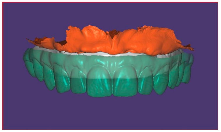 Figure 5