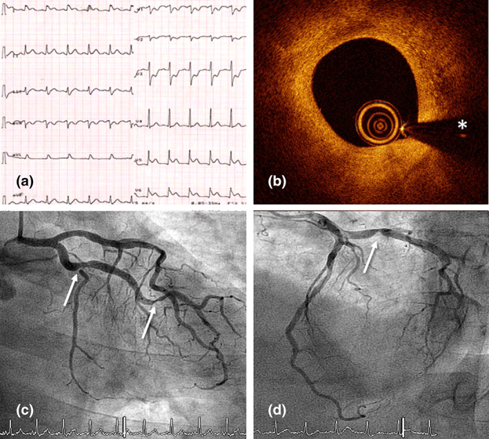 FIGURE 1