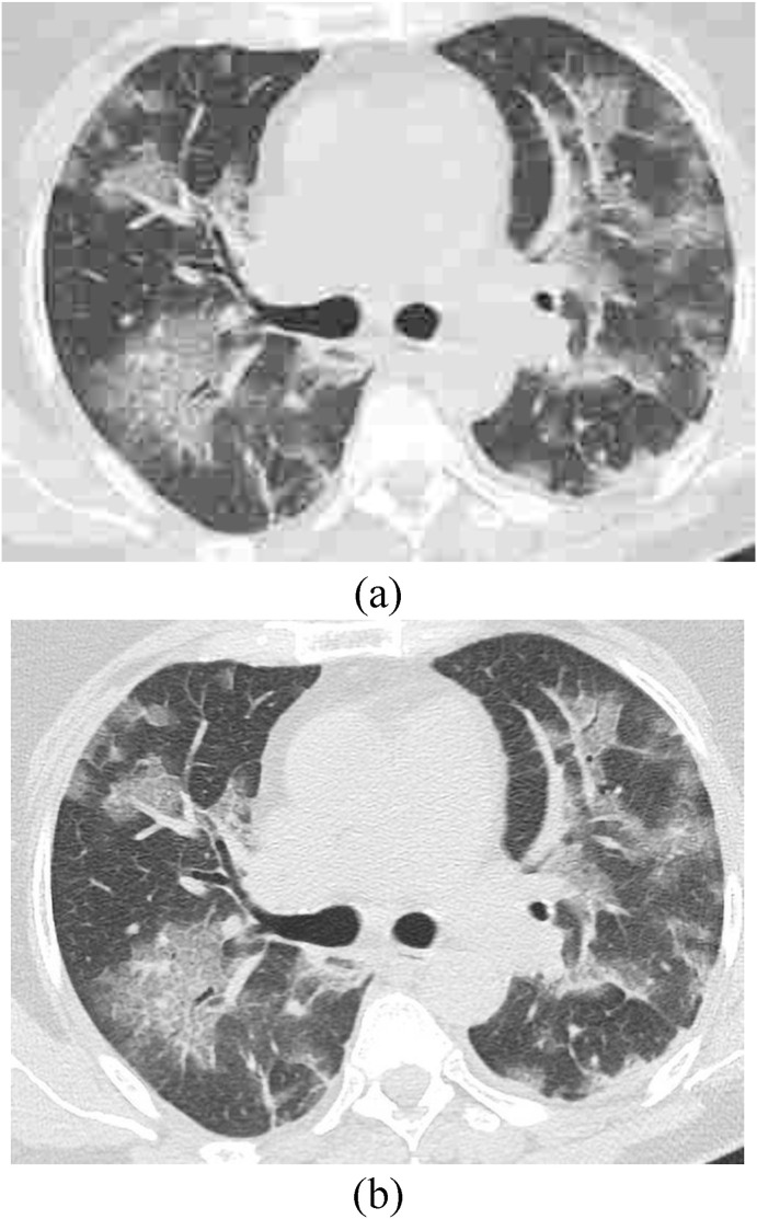 Fig. 5