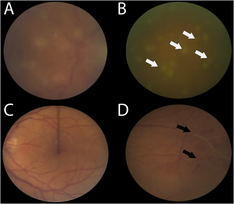 Fig. 1