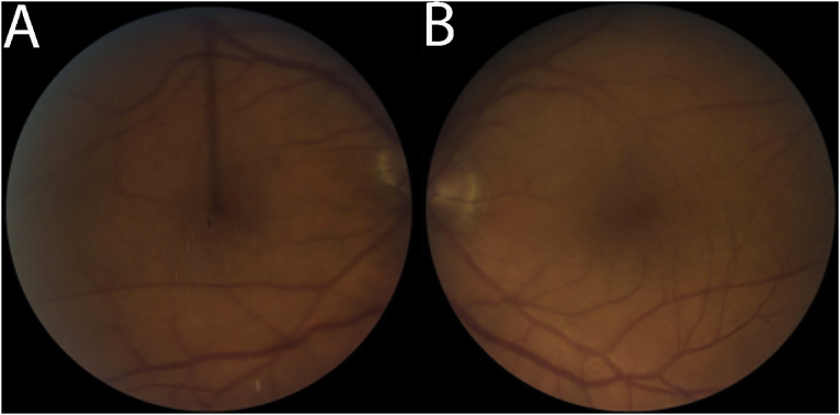 Fig. 4