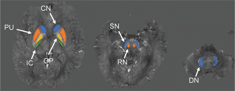 Fig. 3