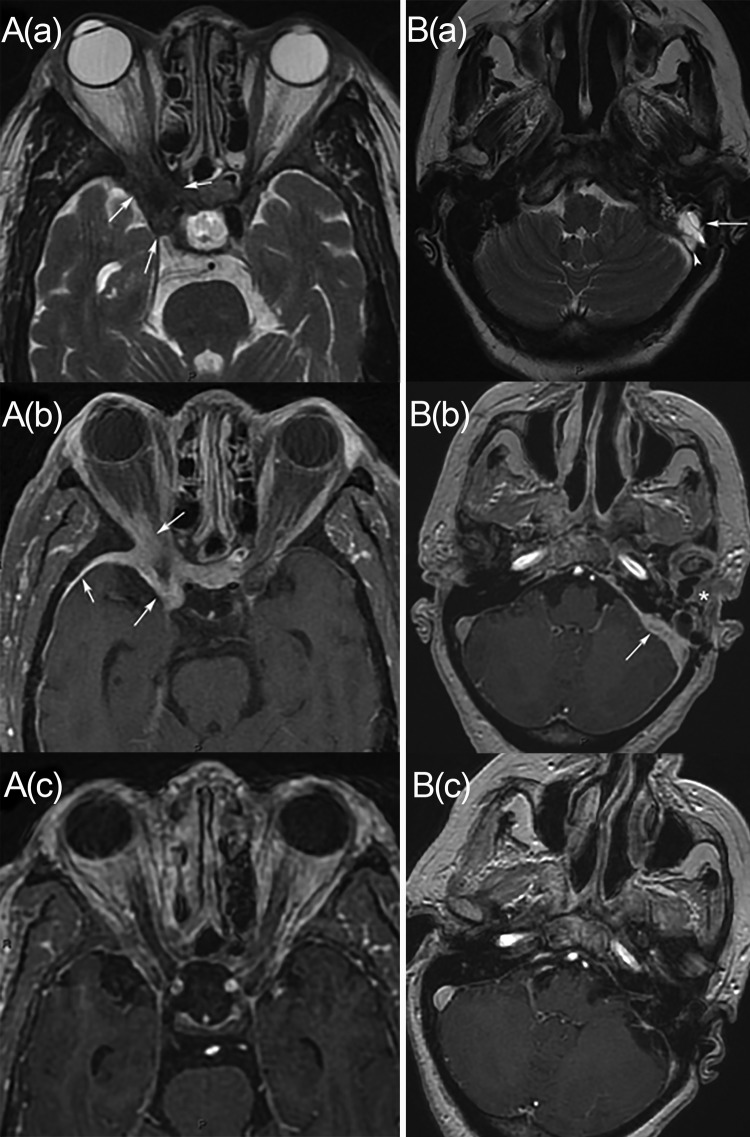 FIG 1