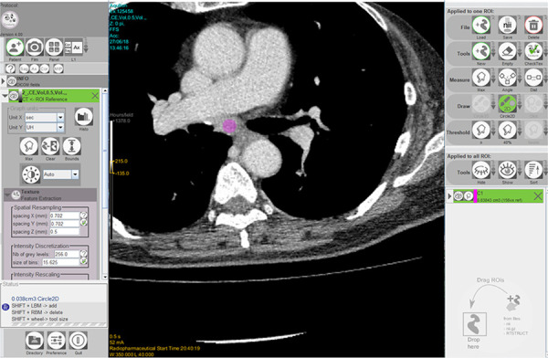 Fig 3