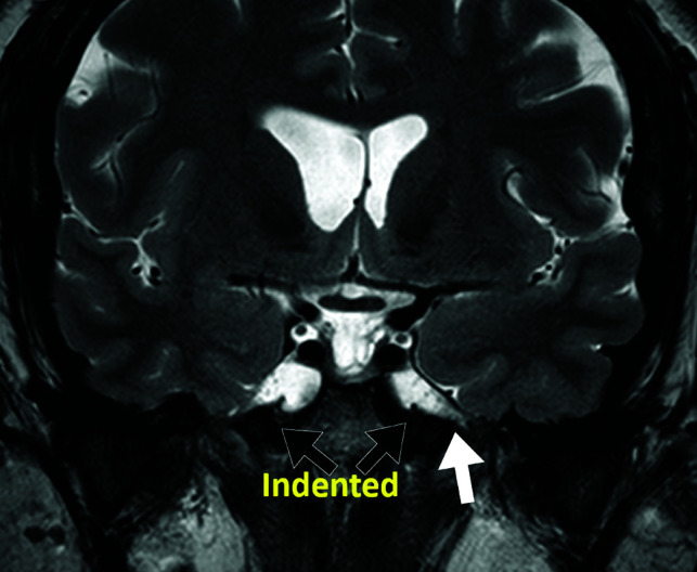 Fig 2.