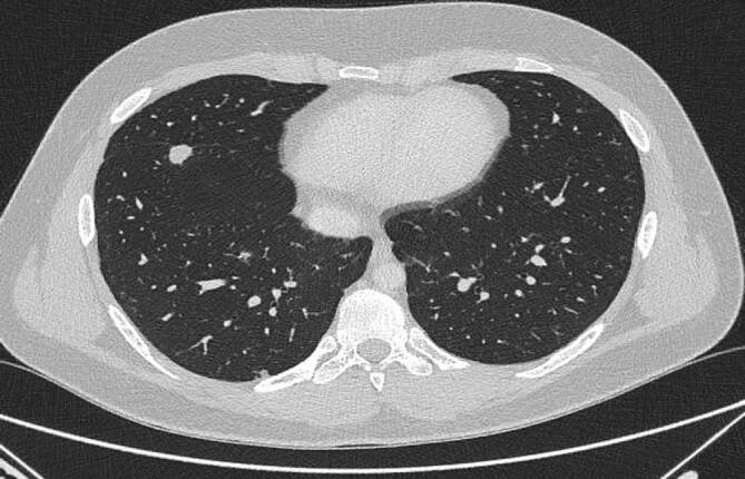 graphic file with name 11654_2023_499_Fig4_HTML.jpg