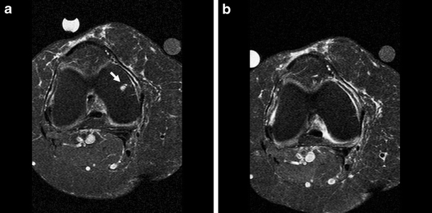 Fig. 2a, b