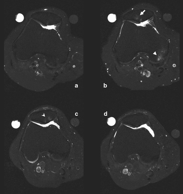 Fig. 1