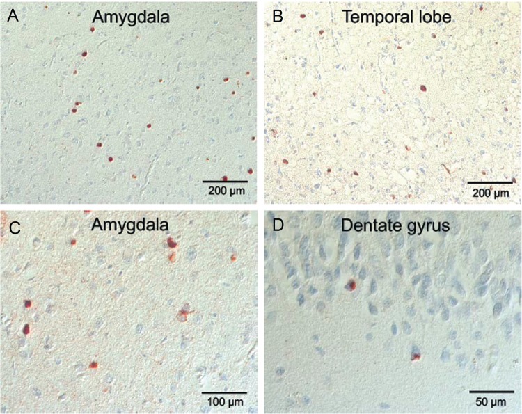 FIGURE 11.