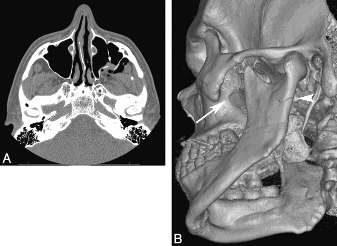 Fig 1.