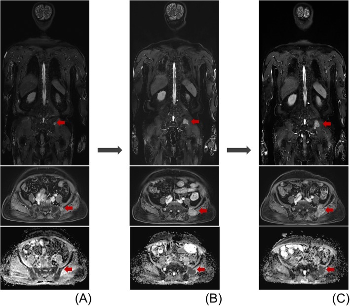 Fig. 2