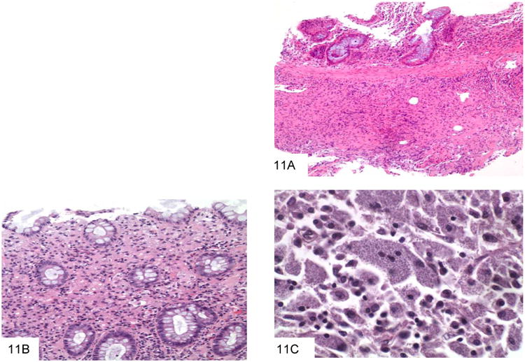 Figure 11