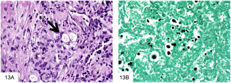 Figure 13