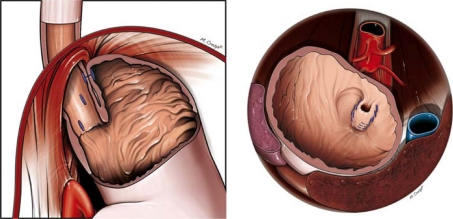 Fig. 1