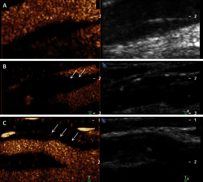 Fig. 4