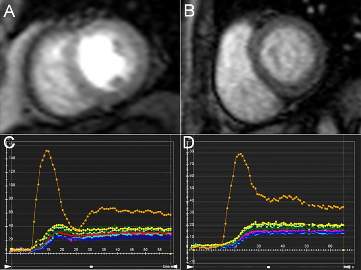 Fig. 1