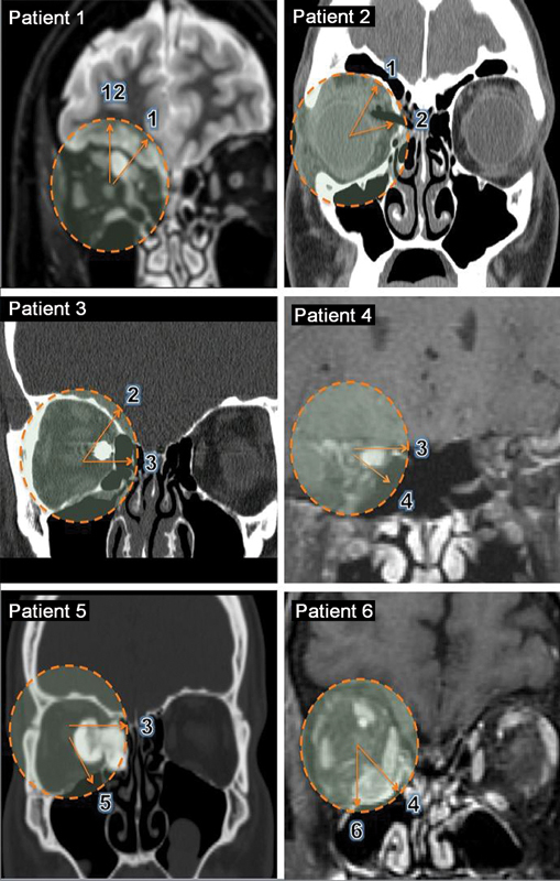 Fig. 5