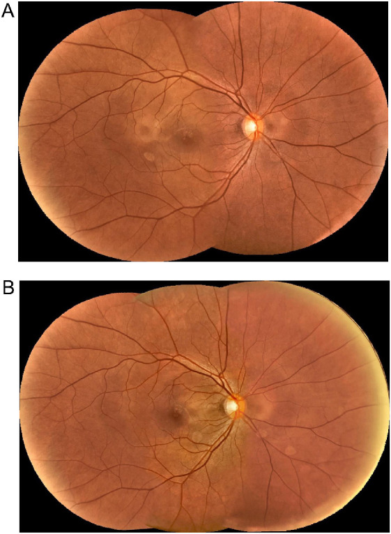 Figure 10.