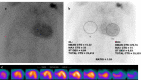Figure 11.