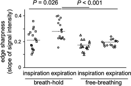 Edge sharpness as an objective criterion for image evaluation. (a) A signal intensity profile in the z-axis was derived at the right diaphragm. After normalization, the mean slope of the signal change between 25% and 75% (black dots) was calculated. (b) Edge sharpness was significantly higher during breath-hold acquisition in expiration. Data are expressed per participant with corresponding mean (dotted line). a.u. = arbitrary units.