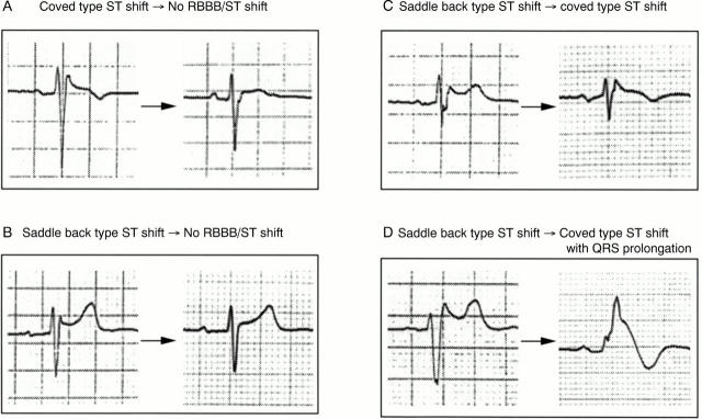 Figure 4  