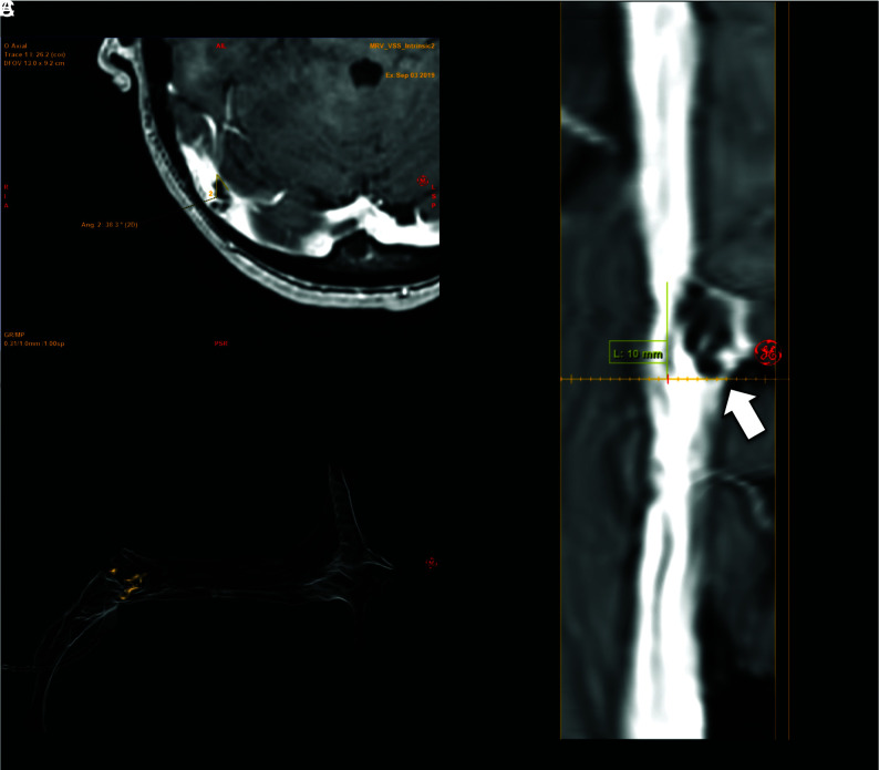 FIG 6.