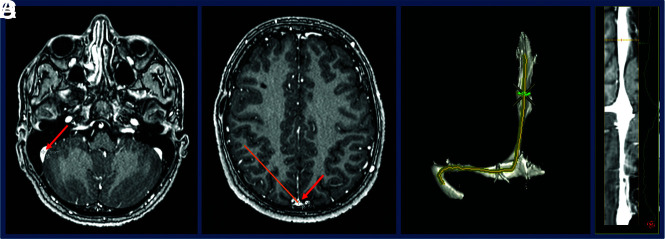 FIG 2.