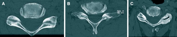 Fig. 4