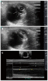 Figure 11