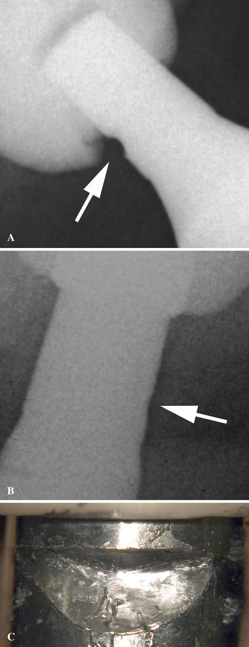 Fig. 4A–C