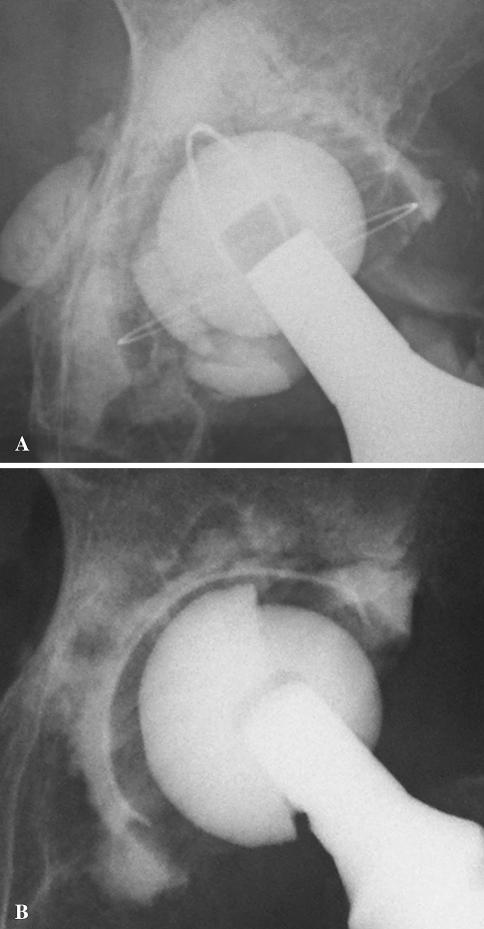 Fig. 2A–B